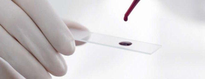 Аст алт кфк анализ крови расшифровка у взрослых норма в таблице thumbnail