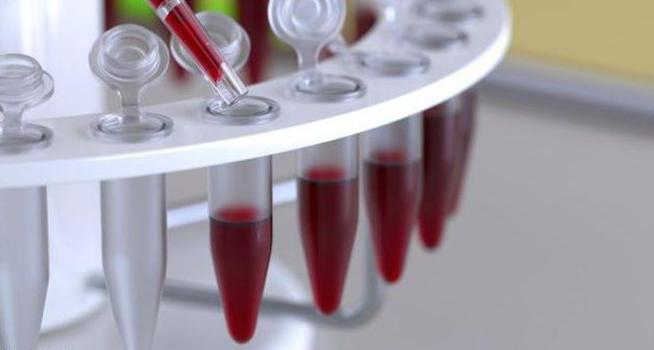 Расшифровка анализа крови HCT