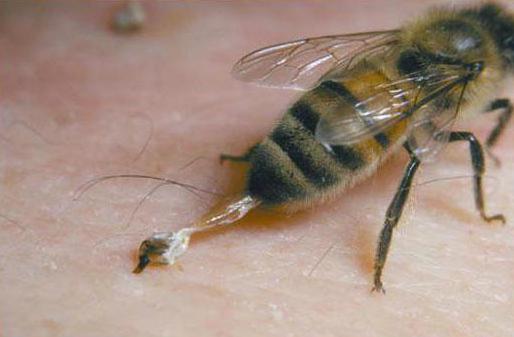 Аллергический отек от укуса пчелы thumbnail