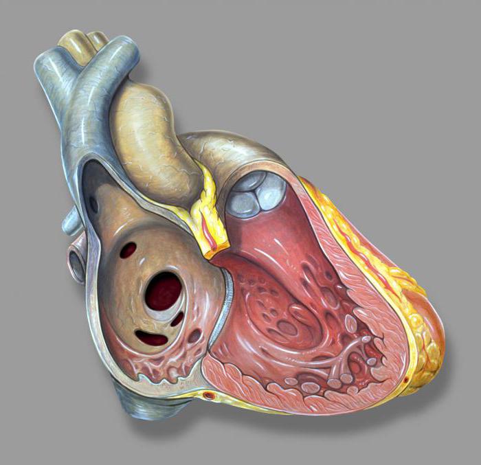 ревматический порок сердца