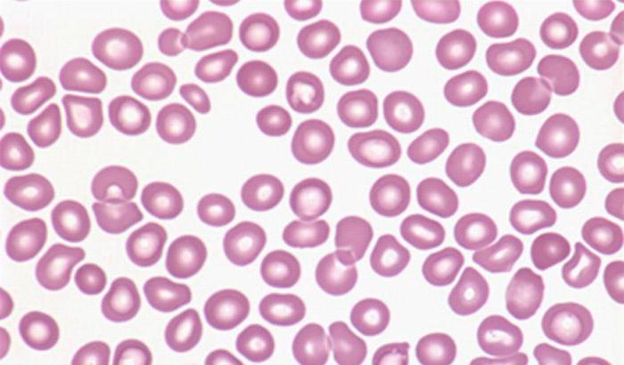тромбоцитопеническая пурпура у взрослых клиника