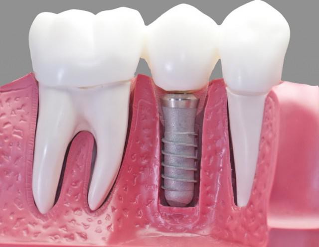 стоматология имплант сити отзывы