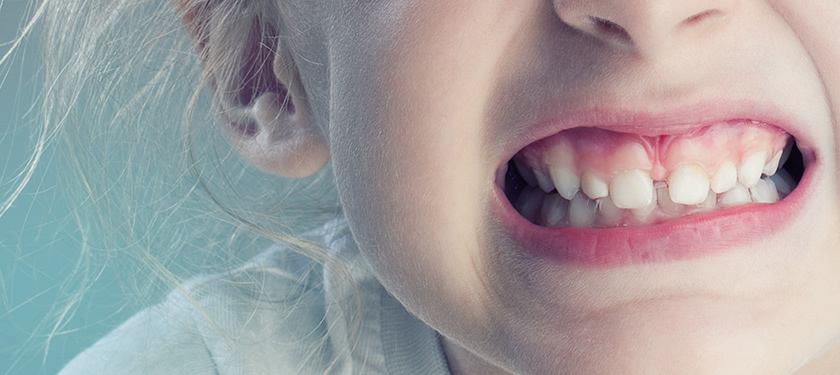 The consequences of why children grind their teeth in a dream