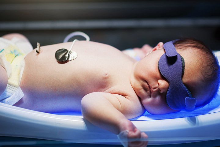 Treatment of jaundice in newborns