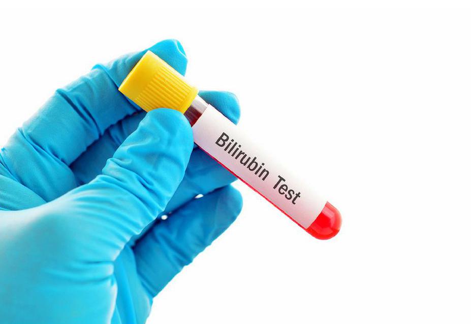 Анализ на уровень билирубина в крови