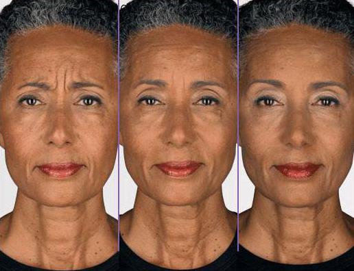 face rejuvenation methods after 60 years