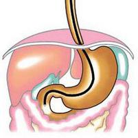 preparation for gastroscopy of the stomach