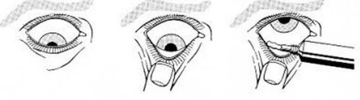 тетрациклиновая мазь глазная инструкция по применению