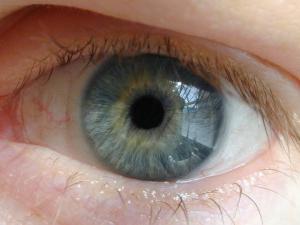 дегенерация желтого пятна глаз
