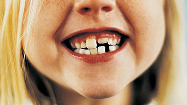 Прорезывание нижних зубов у детей фото
