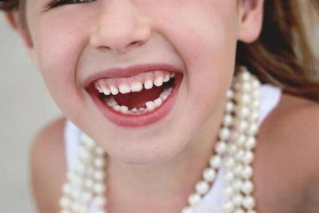 Нарост на десне у ребенка при прорезывании зубов фото