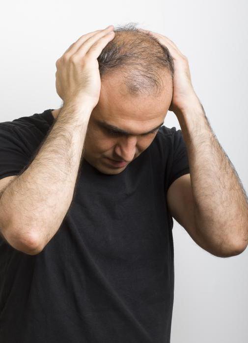 Очаговое выпадение волос у мужчин лечение народными средствами отзывы thumbnail