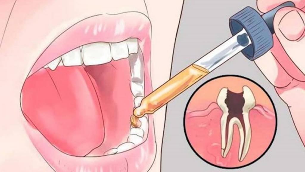 как снять зубную боль