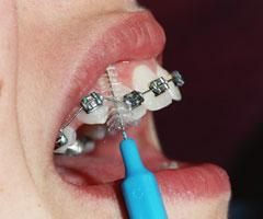 зубная щетка для брекетов oral b 