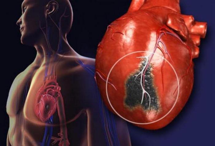 фракция выброса сердца норма после инфаркта