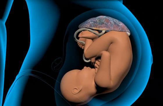 Плацента перед родами 9