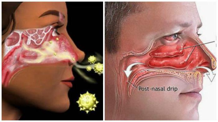 клиническая анатомия носа носовая полость