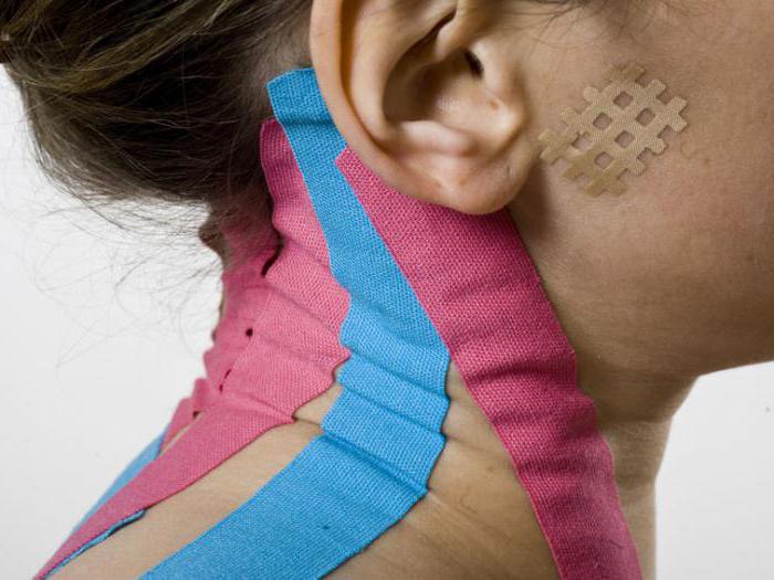 therapeutic kinesiotape