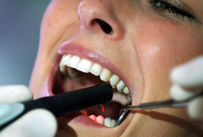 Молочные зубы кариес лечение народными средствами thumbnail