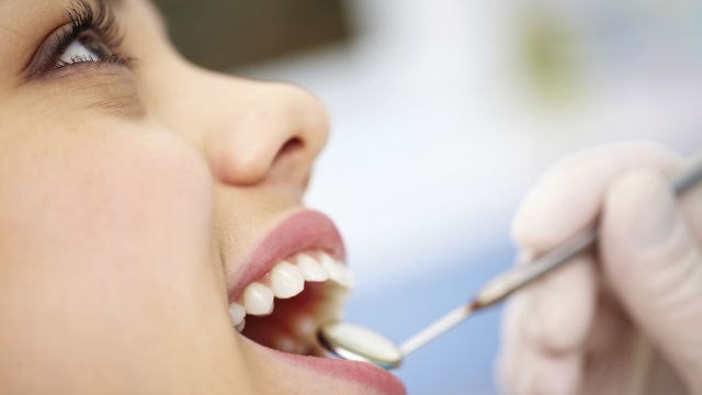 Как пломбируют каналы зуба