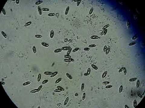 habitat ciliates shoes food