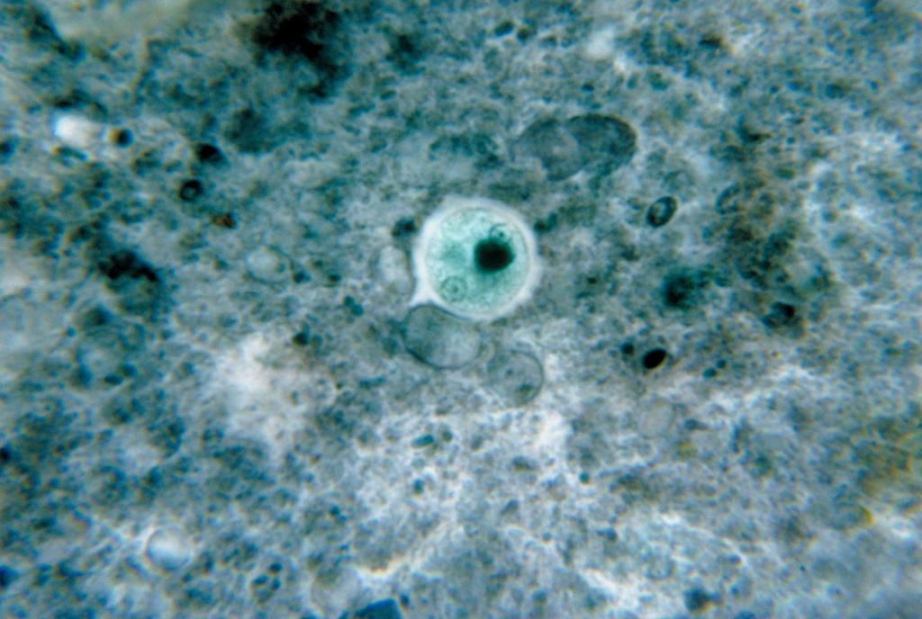 клетка дизентерийной амебы