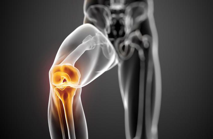 Повреждение мениска коленного сустава лечение