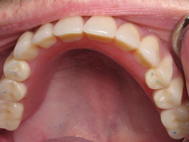анатомия зубов верхней и нижней челюсти