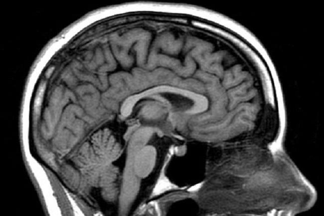 компьютерная томография или мрт что лучше для головного мозга
