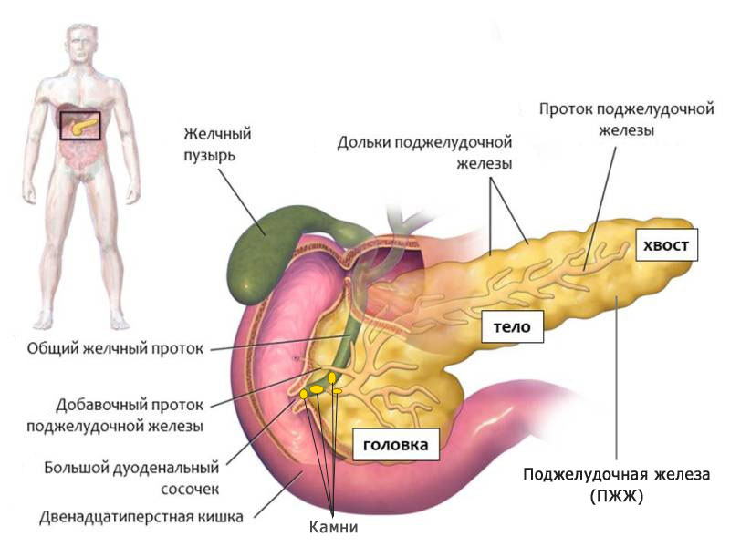 хронический панкреатит и хронический холецистит