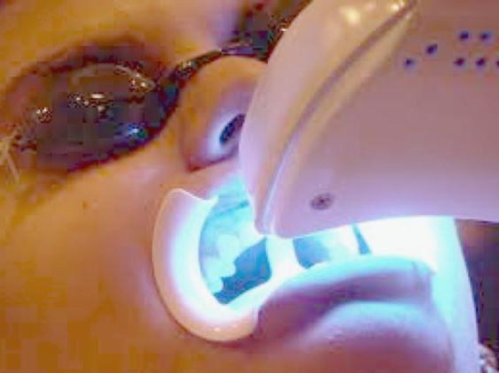 косметическое отбеливание зубов magic white отзывы врачей