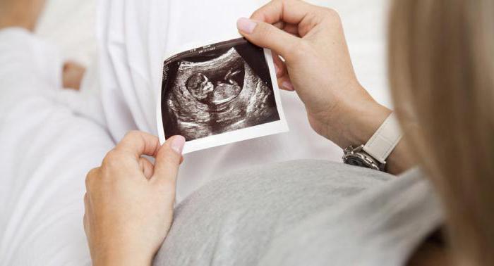 Может ли не быть живота во время беременности thumbnail