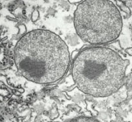 what function do peroxisomes perform