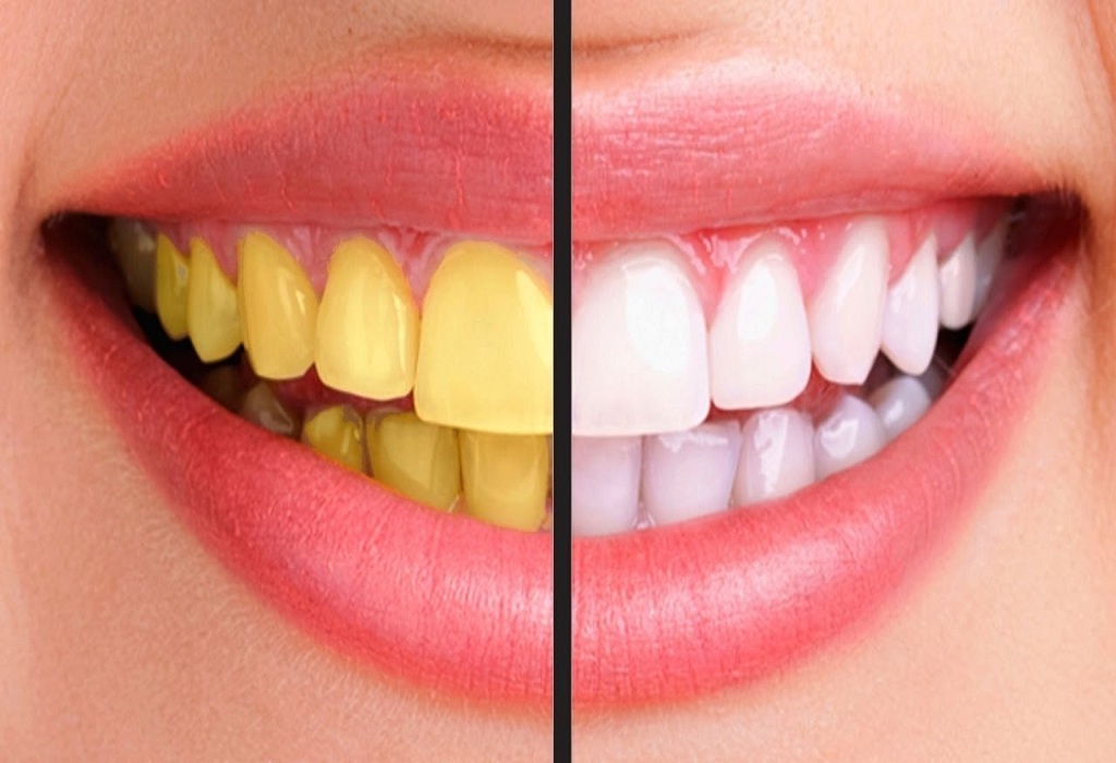Здоровые зубы – хорошее настроение