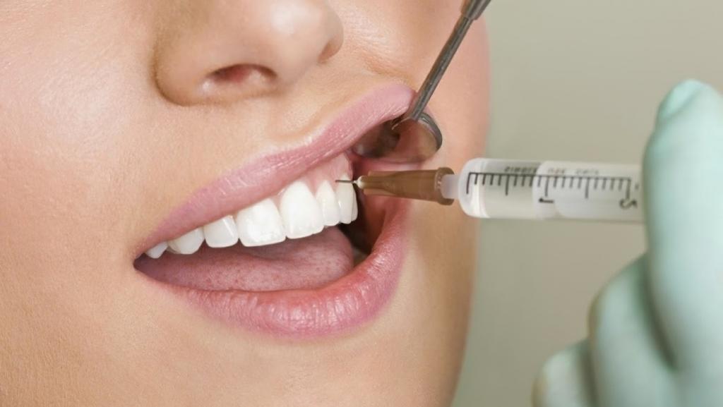Местное обезболивание в стоматологии