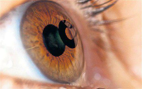 катаракта операция отзывы какой хрусталик лучше