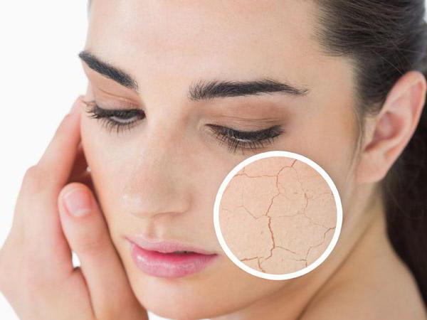 Как удалить шелушение кожи на лице thumbnail