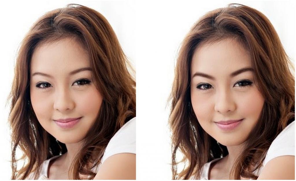 Осветление ануса фото до и после