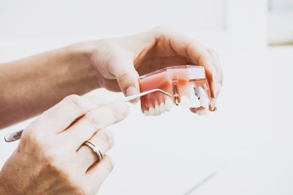 протезирование зубов цирконий