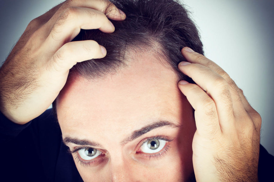восстановление волос на голове у мужчин