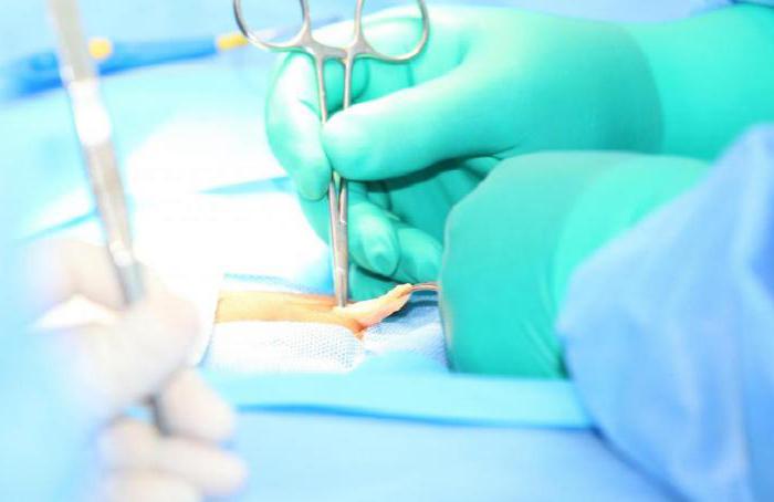 Операция по удалению пупочной грыжи у ребенка в больнице thumbnail