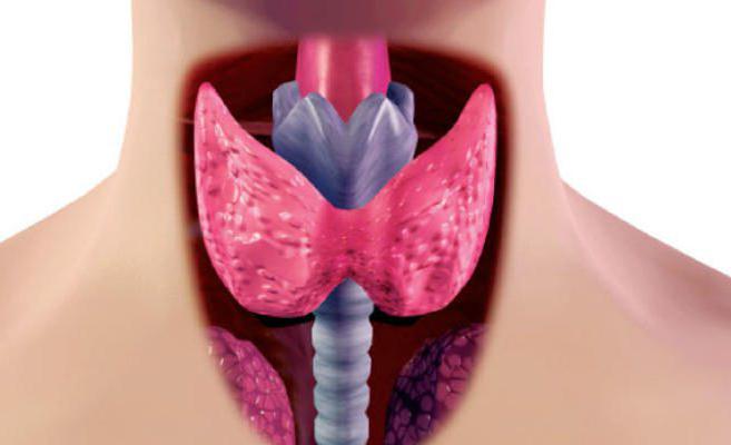 многоузловой коллоидный зоб щитовидной железы