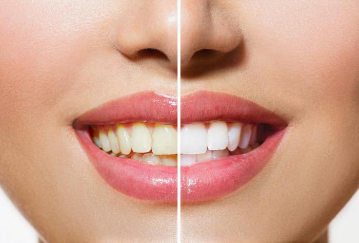 Отбеливание зубов Amazing White отзывы