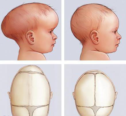 Форма головы ребенка 3 года thumbnail
