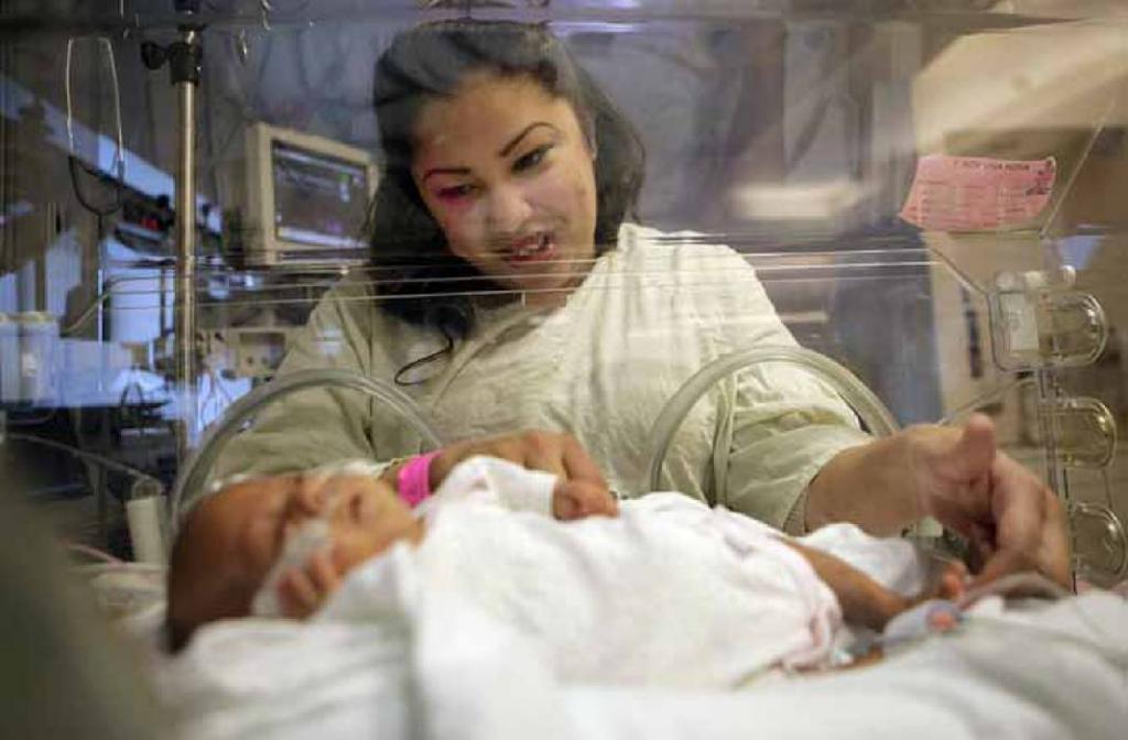 the smallest born baby in the world