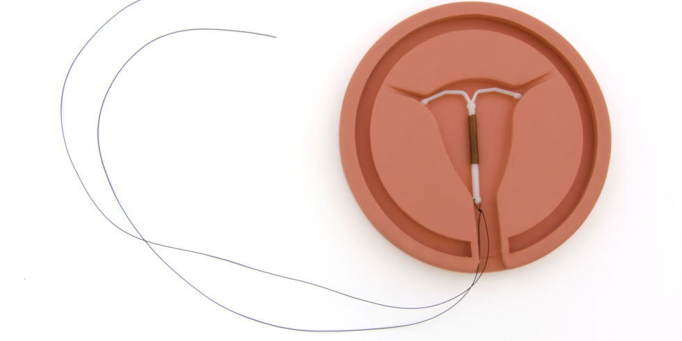 The introduction of intrauterine contraceptives