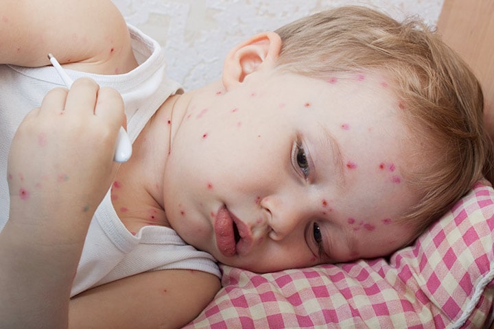 the incubation period of chickenpox in children how long