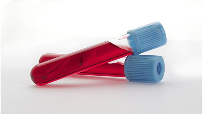 Какими буквами обозначают лейкоциты в анализе крови thumbnail