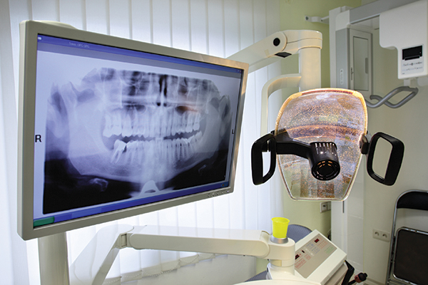 рентген снимок зубов