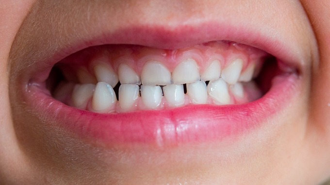 болят ли молочные зубы у детей и как успокоить эту боль